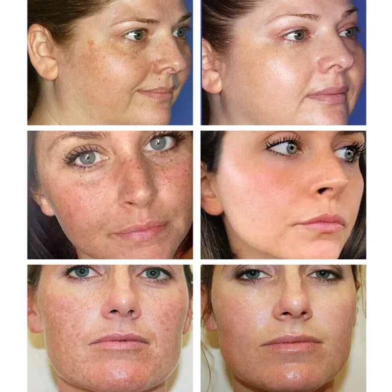 Turmeric Whitening Face Toner Effective Remove Dark Spots Melasma Moisturize Brighten Smooth For Black Skin Tone Beauty Health