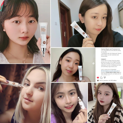 Peptide Collagen Eye Cream Anti Wrinkle Anti Dark Circles Eye Bags Skincare Products Against Puffiness Korean Skin Care Products